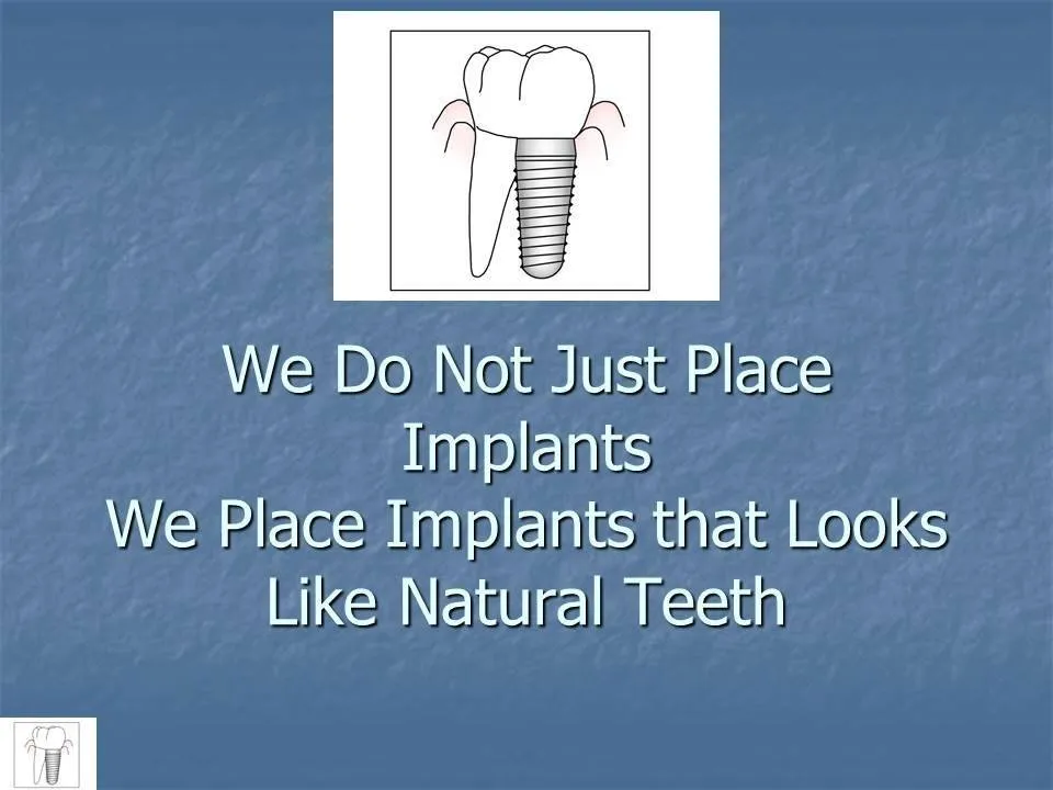 provisional implant placement slide