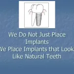 provisional implant placement slide