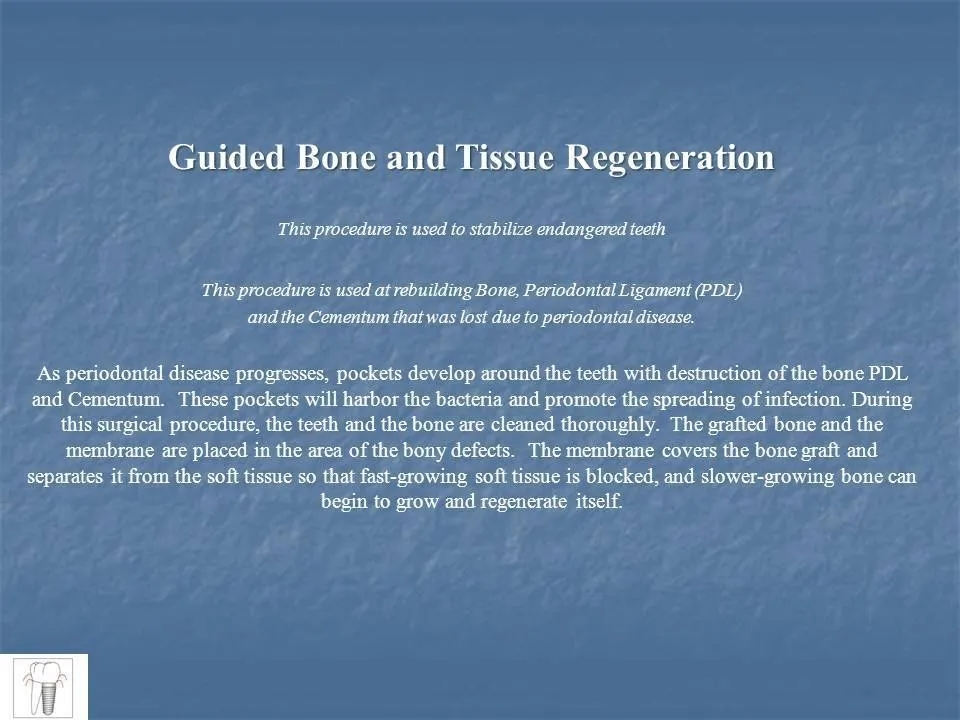 guided tissue regeneration slide